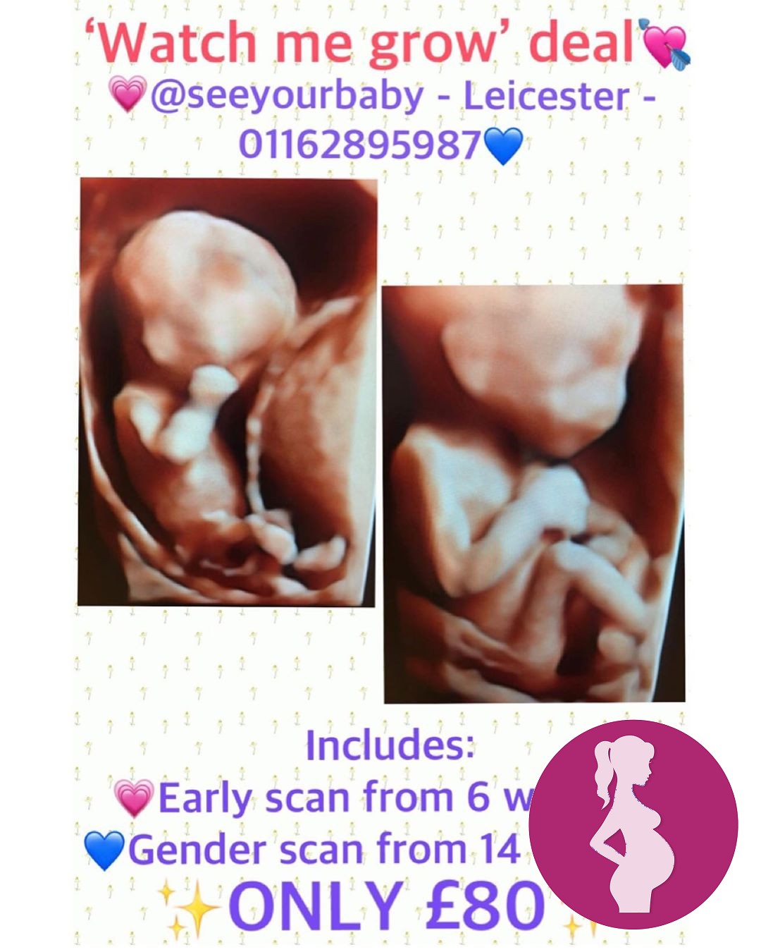Amazing Watch Me Grow Dealincludes an early pregnancy scan from 6 weeks and gender scan from 14 …