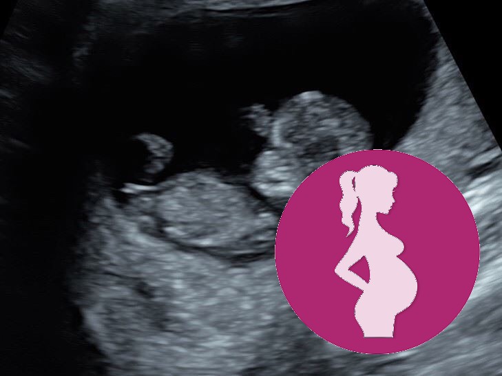 Whats Our Promise at firstScan at Window to the Womb Leicester – Private Scans from Just…