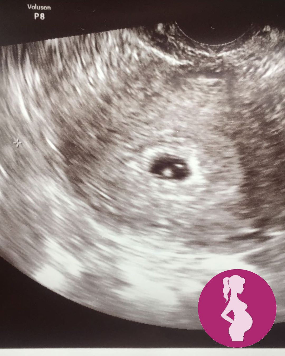 NOT A PREGNANCY ANNOUNCEMENTNightmare on Belvedere Manor..- now up on my blog babynu…