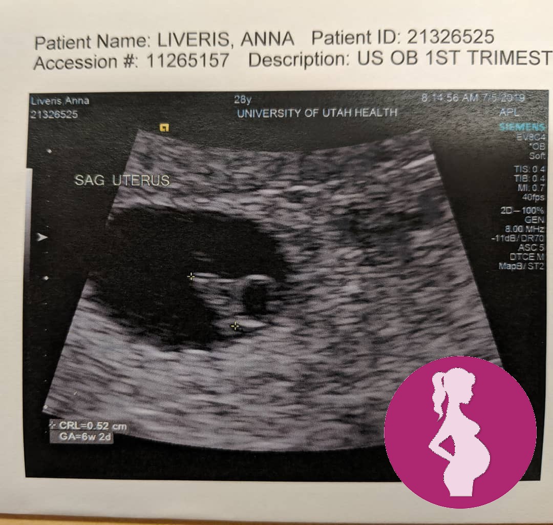 Heartbreaking news. I have been absent more often here because I was pregnant. Had a 10 week ultraso…