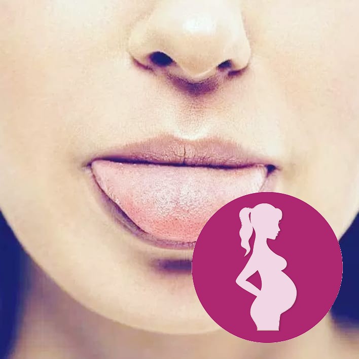 Have you had dysgeusia in pregnancy How long did it last and what helped you to alleviate itWhile…