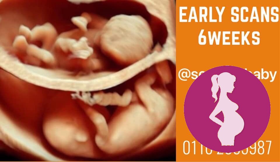 See your little one grow from as early as 6 weeks here at book nowclick for number mi…