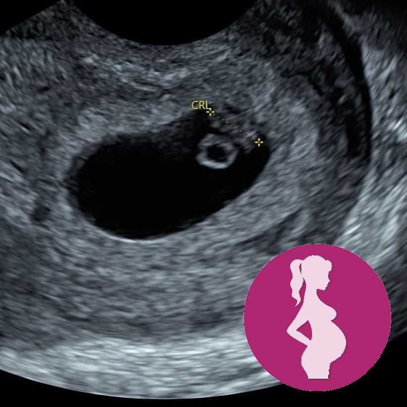 The Journey From 6 Weeks To 12 Weeks ….windowtothewombmaidstone preggo pregnancyscan pr…