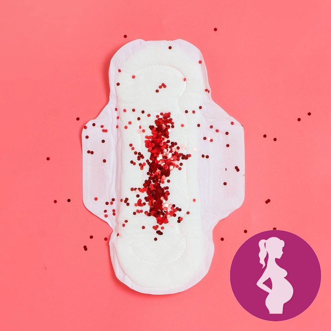 Did anyone else get a really bizarre period after MVA treatment …. Aunt Flow FINALLY showed up ex…