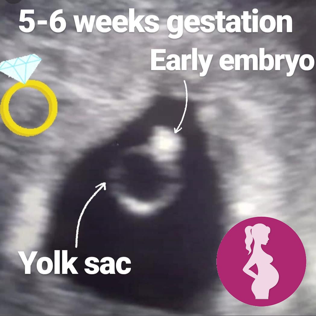 We offer early scans from 7 weeks of pregnancy.If you come before this gestation it can be TOO EAR…