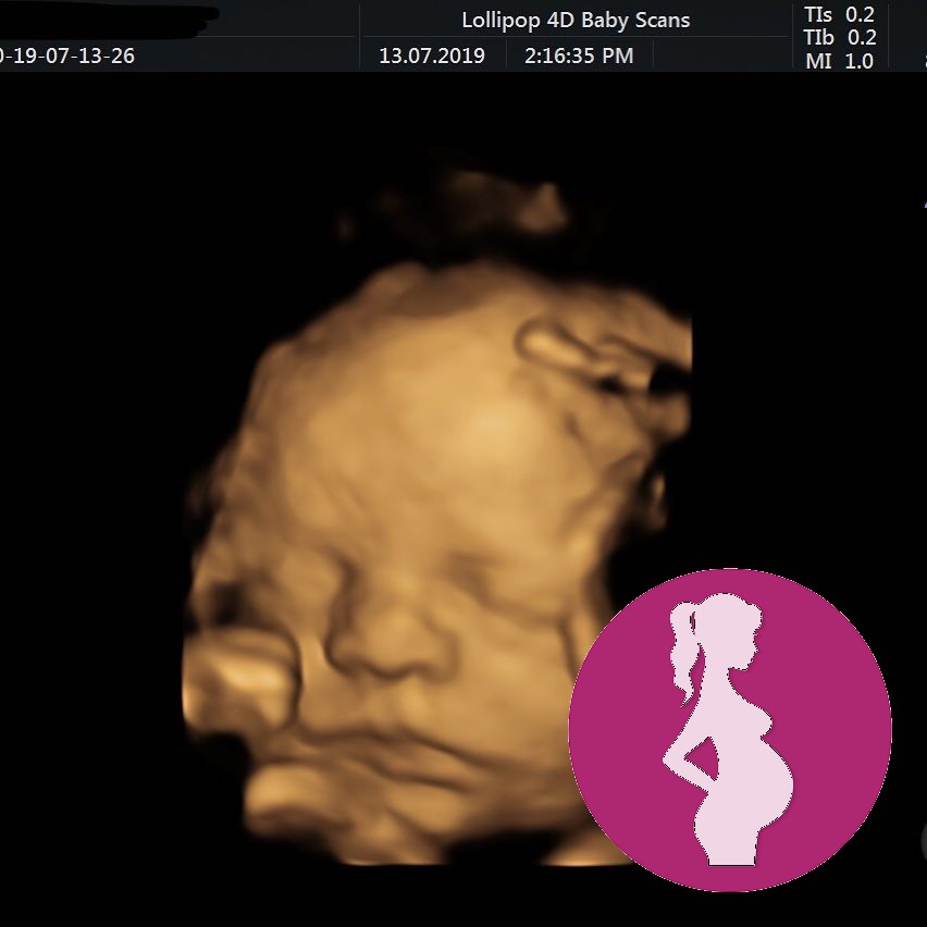 Hello Cutie babyscan positivetest earlypregnancysymptoms earlypregnancy pregnant pregnancy …