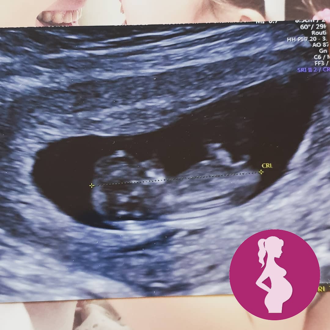 Tuesdays private 10 week scan There was an awful 30 second pause before the ultrasound technician …